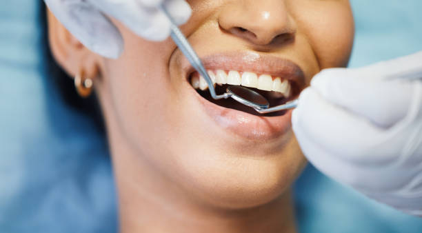 Best Emergency Treatment for Dental Infections or Abscesses in Grill, PA